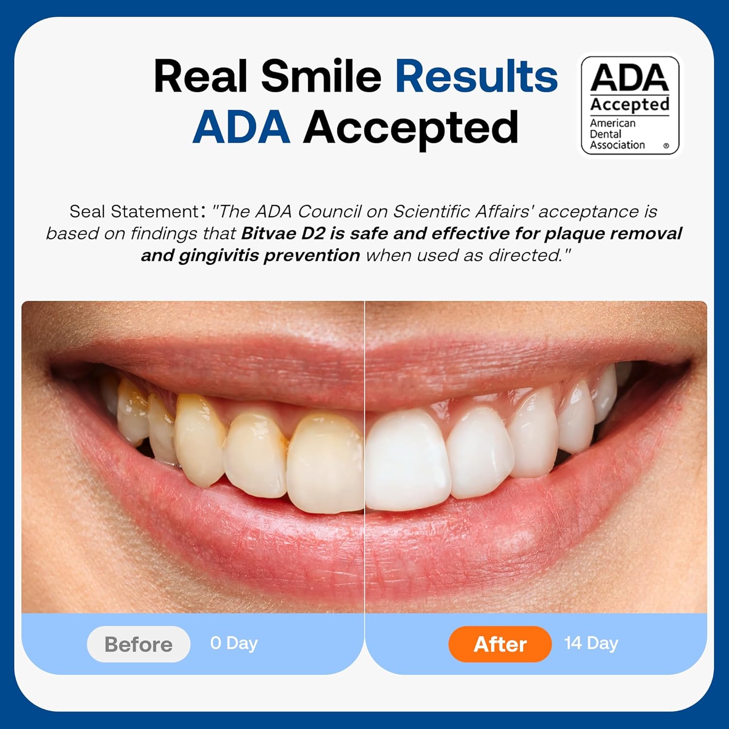 81aTRhy3YlL._AC_SL1500_.jpg 81aTRhy3YlL._AC_SL1500_.jpg