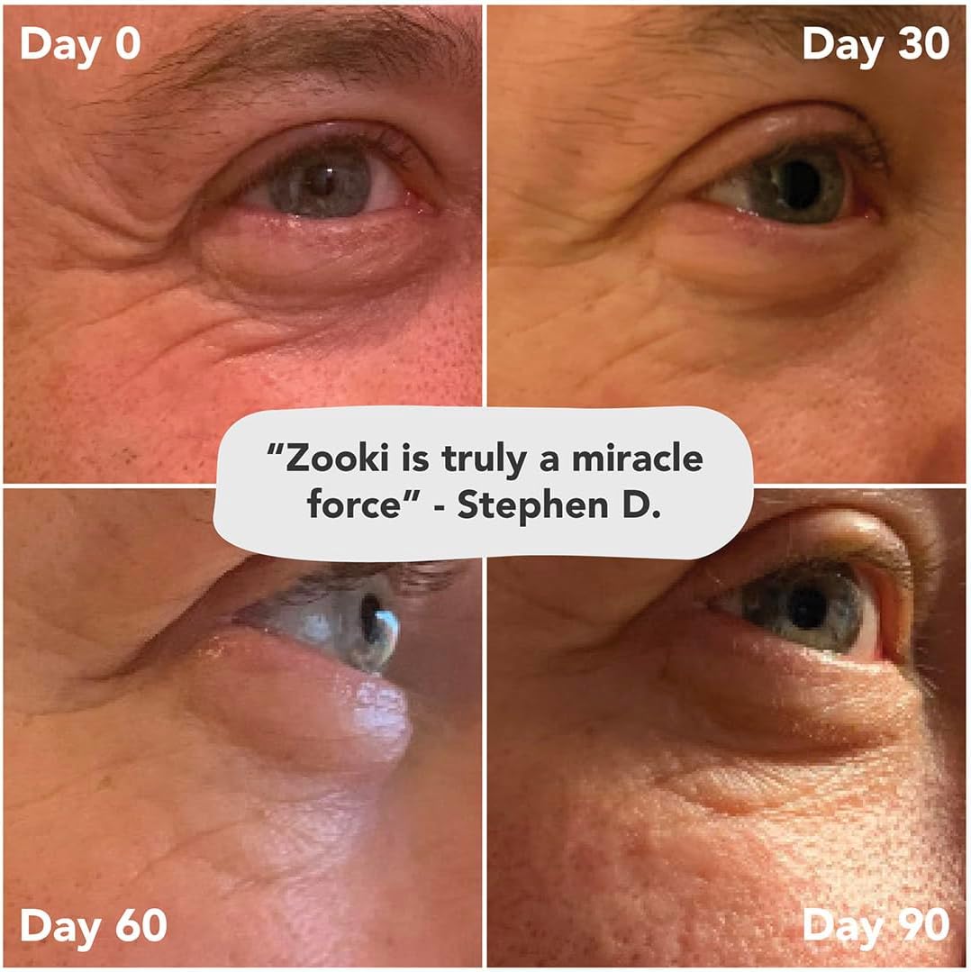 61mY7fEBHzL._AC_SL1080_.jpg 61mY7fEBHzL._AC_SL1080_.jpg