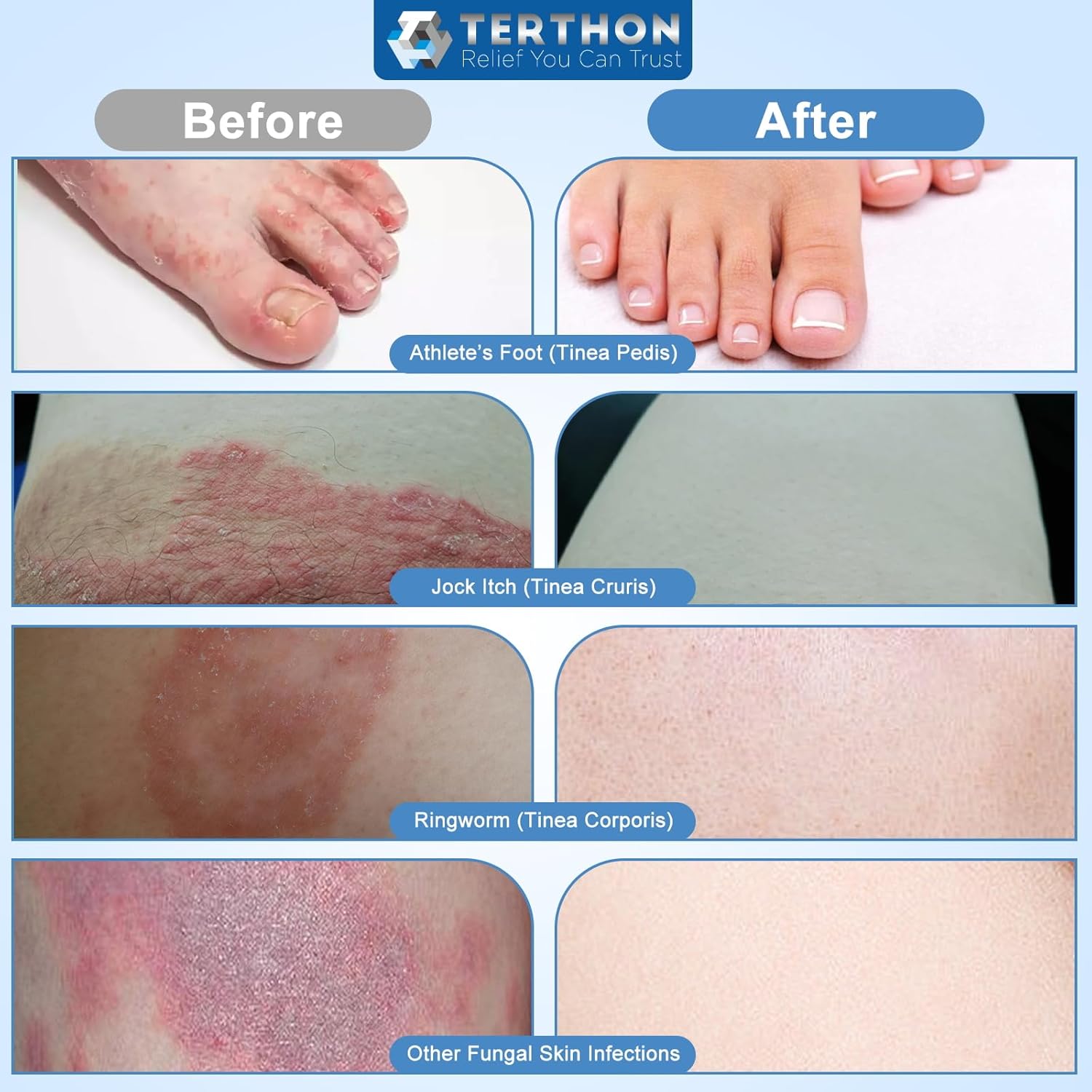 7177foWPMfL._AC_SL1500_.jpg 7177foWPMfL._AC_SL1500_.jpg